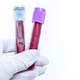 Imagen para el artículo titulado Oxford desarrolla una prueba de sangre que puede detectar tumores y metástasis temprano